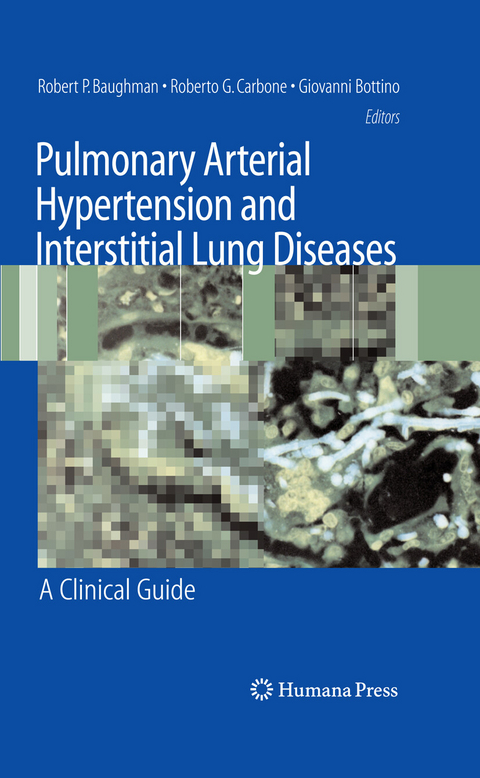 Pulmonary Arterial Hypertension and Interstitial Lung Diseases - 