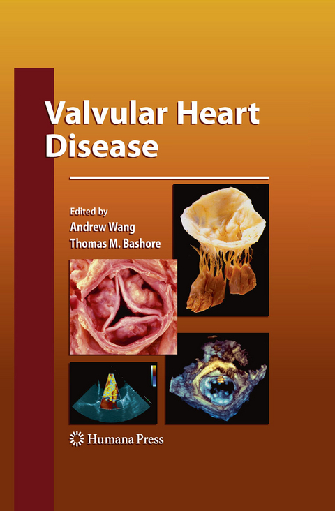 Valvular Heart Disease - 