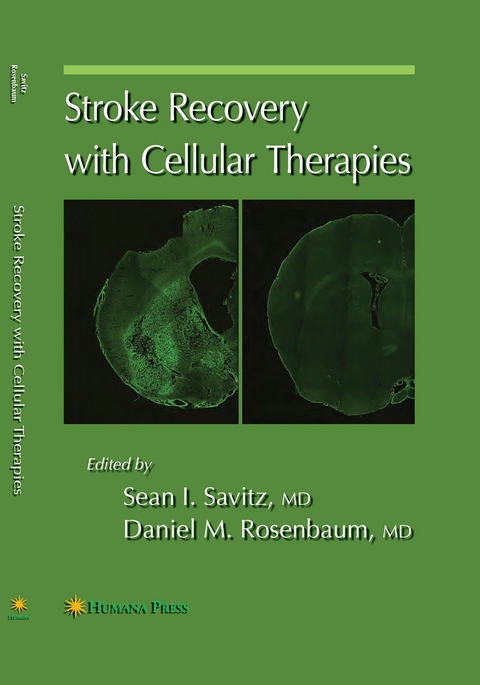 Stroke Recovery with Cellular Therapies - 