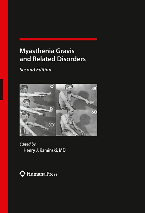 Myasthenia Gravis and Related Disorders - 