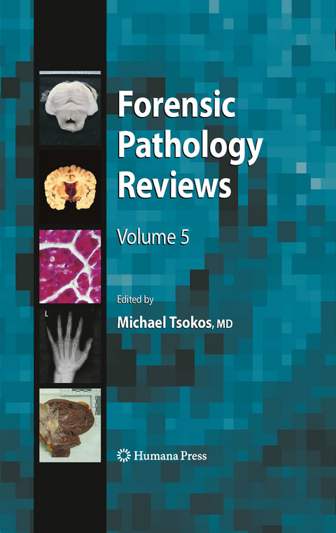 Forensic Pathology Reviews 5 - 