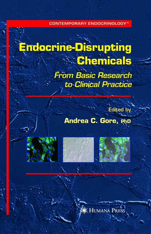 Endocrine-Disrupting Chemicals - 