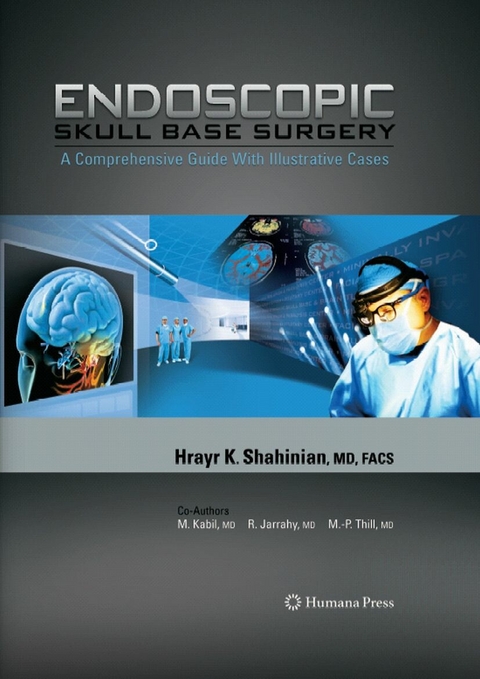 Endoscopic Skull Base Surgery - Hrayr K. Shahinian