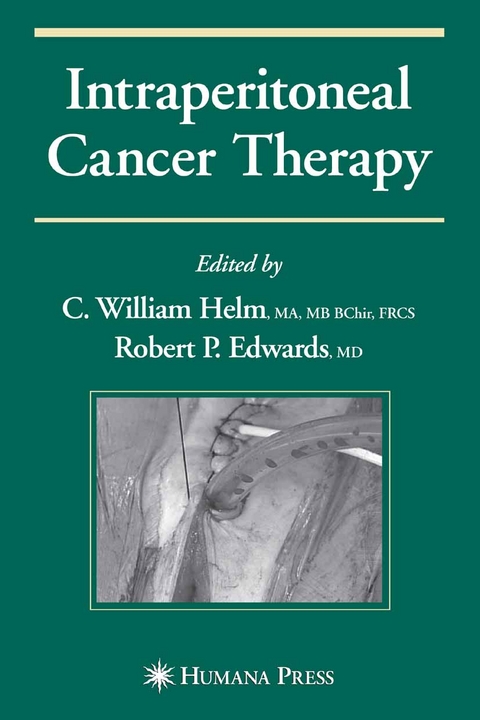 Intraperitoneal Cancer Therapy - 