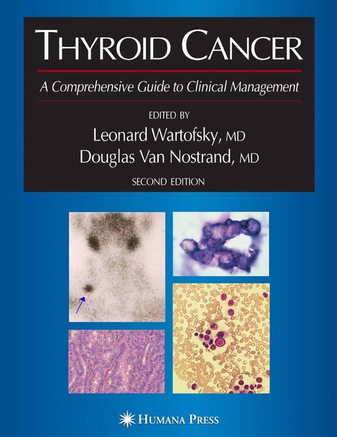 Thyroid Cancer - 