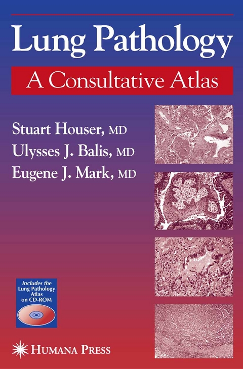 Lung Pathology - Stuart Houser, Eugene J. Mark, Ulysses J. Balis