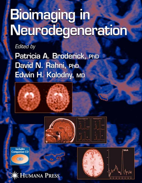 Bioimaging in Neurodegeneration - 