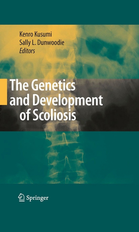 Genetics and Development of Scoliosis - 