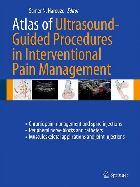 Atlas of Ultrasound-Guided Procedures in Interventional Pain Management - 