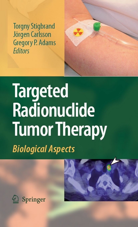 Targeted Radionuclide Tumor Therapy - 