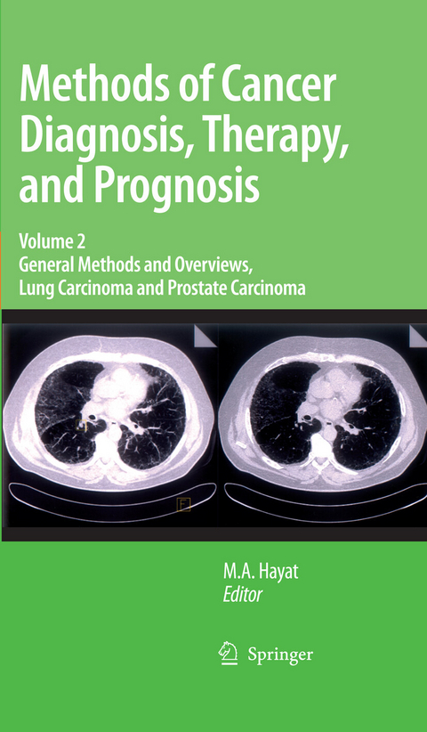 Methods of Cancer Diagnosis, Therapy and Prognosis - 