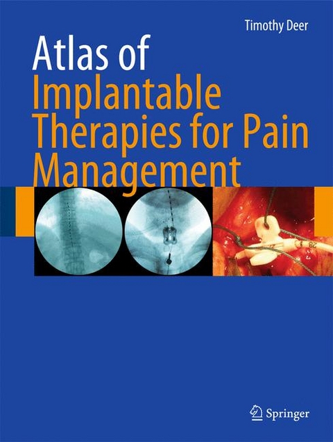 Atlas of Implantable Therapies for Pain Management - Timothy R Deer