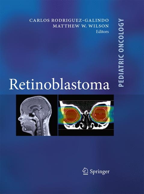 Retinoblastoma - 