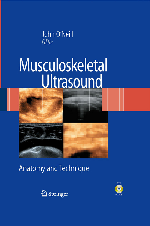 Musculoskeletal Ultrasound - 