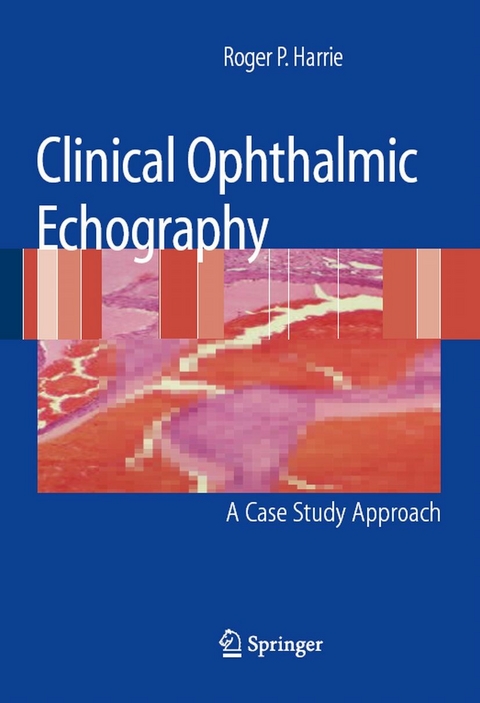 Clinical Ophthalmic Echography - Roger P. Harrie