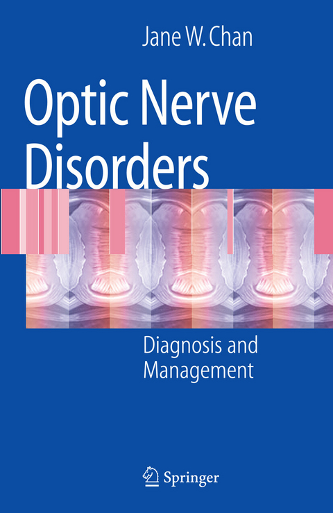 Optic Nerve Disorders -  Jane W. Chan