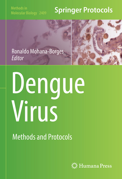 Dengue Virus - 