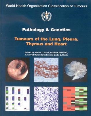 Pathology and genetics of tumours of the lung, plura, thymus and heart -  International Agency for Research on Cancer,  World Health Organization,  International Academy of Pathology