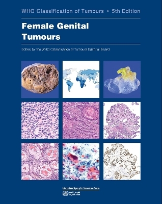 WHO classification of female genital tumours -  International Agency for Research on Cancer,  World Health Organization