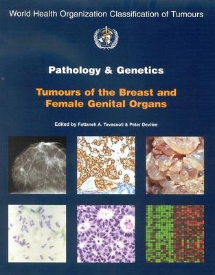 Pathology and Genetics of Tumours of the Breast and Female Genital Organs - Peter Deville, Fattaneh A. Tavassoli,  International Agency for Research on Cancer