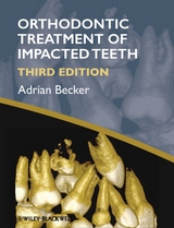 Orthodontic Treatment of Impacted Teeth - Adrian Becker