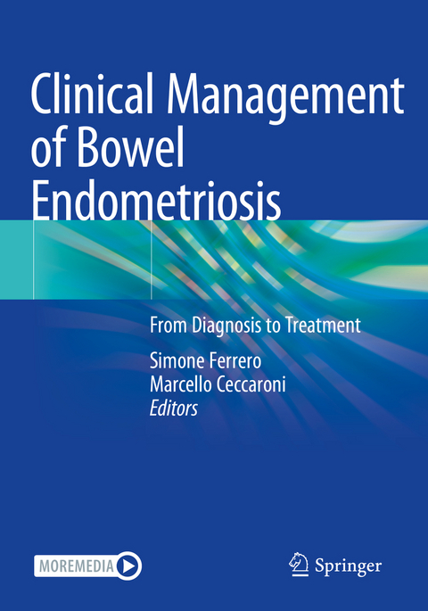 Clinical Management of Bowel Endometriosis - 