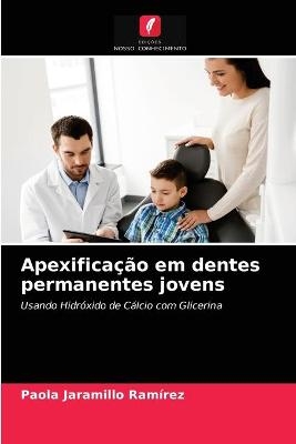 Apexificação em dentes permanentes jovens - Paola Jaramillo Ramírez