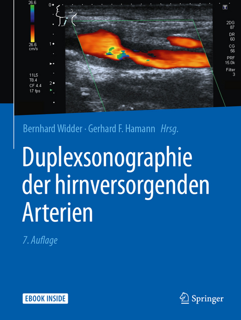 Duplexsonographie der hirnversorgenden Arterien - 