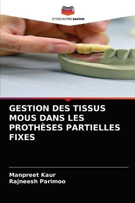 Gestion Des Tissus MOUS Dans Les Prothèses Partielles Fixes - Manpreet Kaur, Rajneesh Parimoo