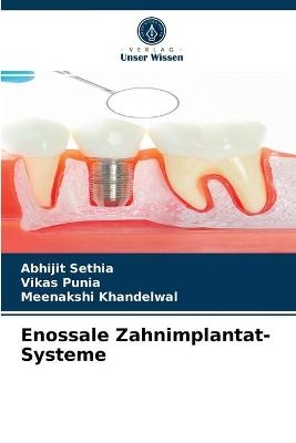 Enossale Zahnimplantat-Systeme - Abhijit Sethia, Vikas Punia, Meenakshi Khandelwal