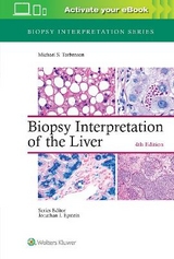 Biopsy Interpretation of the Liver - Torbenson, Michael