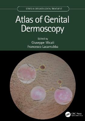 Atlas of Genital Dermoscopy