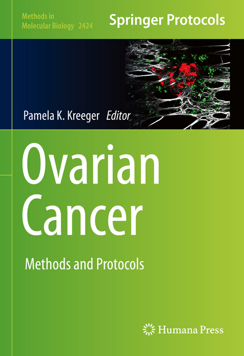 Ovarian Cancer - 