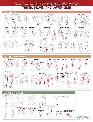 Travell, Simons & Simons’ Trigger Point Pain Patterns Wall Chart