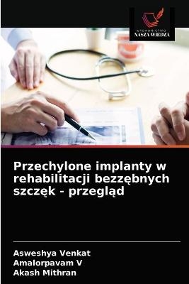 Przechylone implanty w rehabilitacji bezzębnych szczęk - przegląd - Asweshya Venkat, Amalorpavam V, Akash Mithran