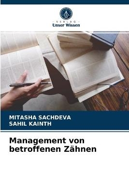 Management von betroffenen Zähnen - Mitasha Sachdeva, Sahil Kainth