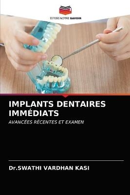 Implants Dentaires Immédiats - Dr Swathi Vardhan Kasi